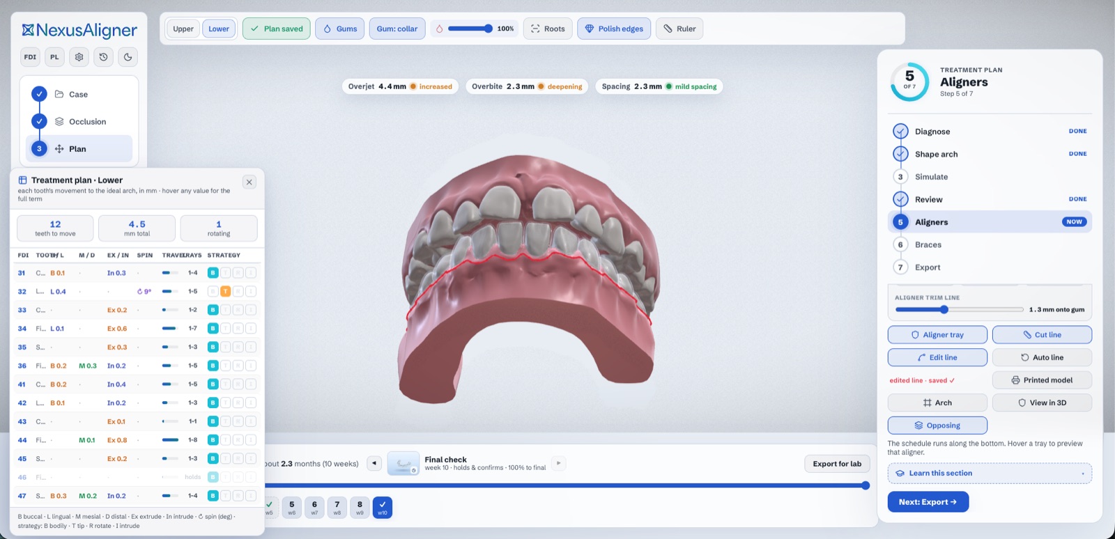 The NexusAligner planning workspace, showing the case steps, the 3D occlusion with the aligner trim line, and the per-tooth movement table.